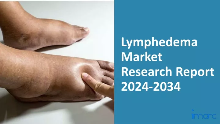 lymphedema market research report 2024 2034