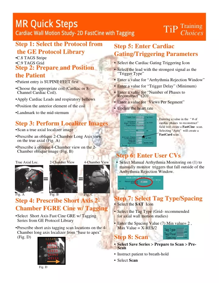 mr quick steps cardiac wall motion study