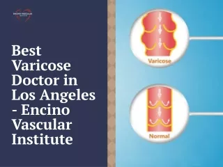 Best Varicose Doctor in Los Angeles - Encino Vascular Institute