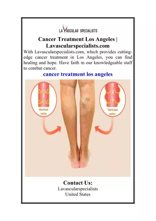 Cancer Treatment Los Angeles  Lavascularspecialists.com