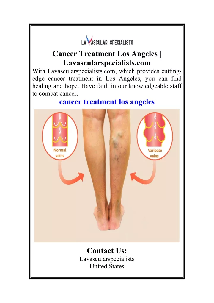 cancer treatment los angeles