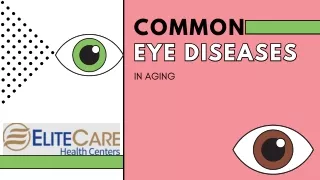Common Eye Diseases in Aging | Elite Care Health Centers