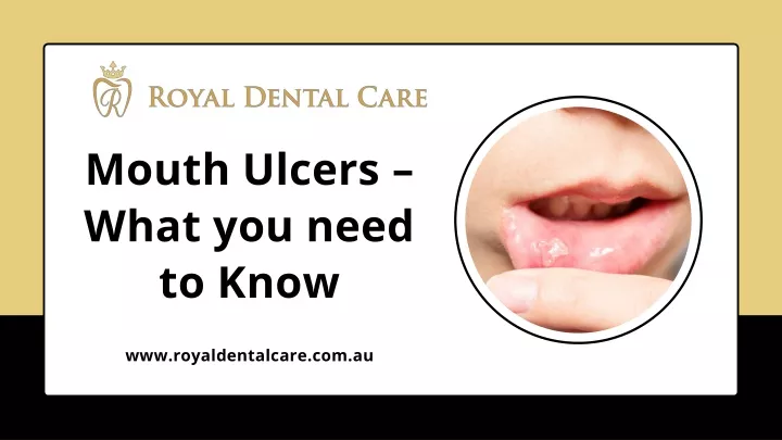 mouth ulcers what you need to know