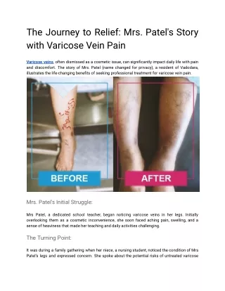 The Journey to Relief_ Mrs. Patel's Experience with Varicose Vein Pain
