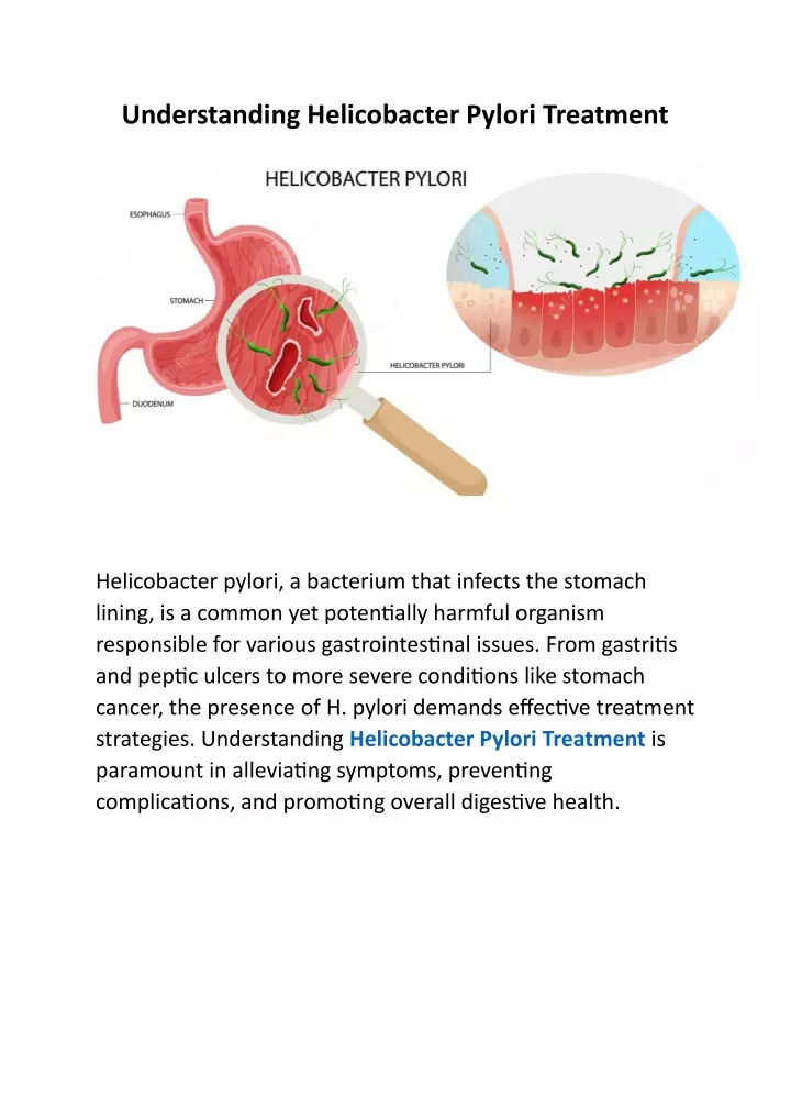 understanding helicobacter pylori treatment