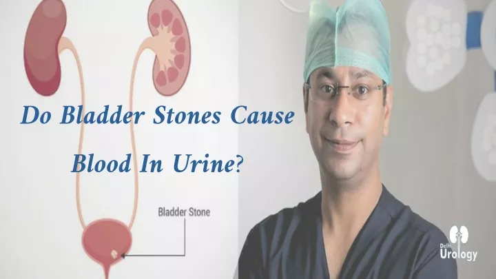 do bladder stones cause blood in urine