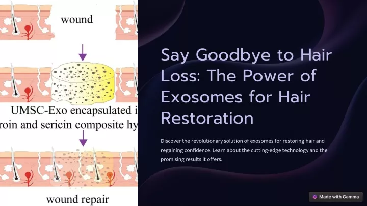 say goodbye to hair loss the power of exosomes