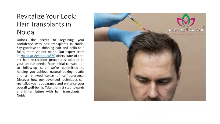 revitalize your look hair transplants in noida