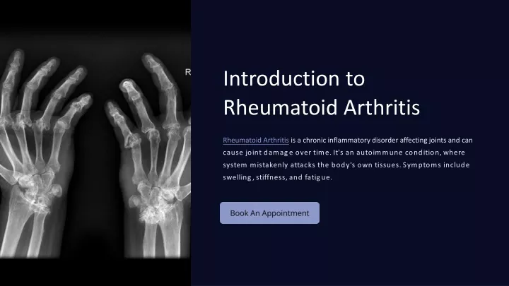 introduction to rheumatoid arthritis