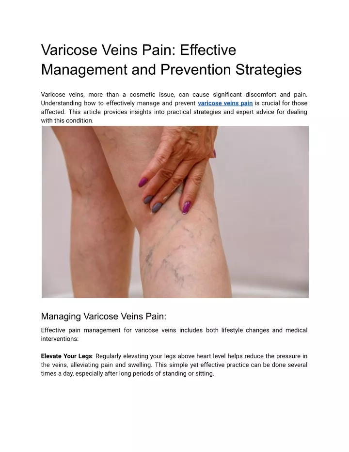 varicose veins pain effective management