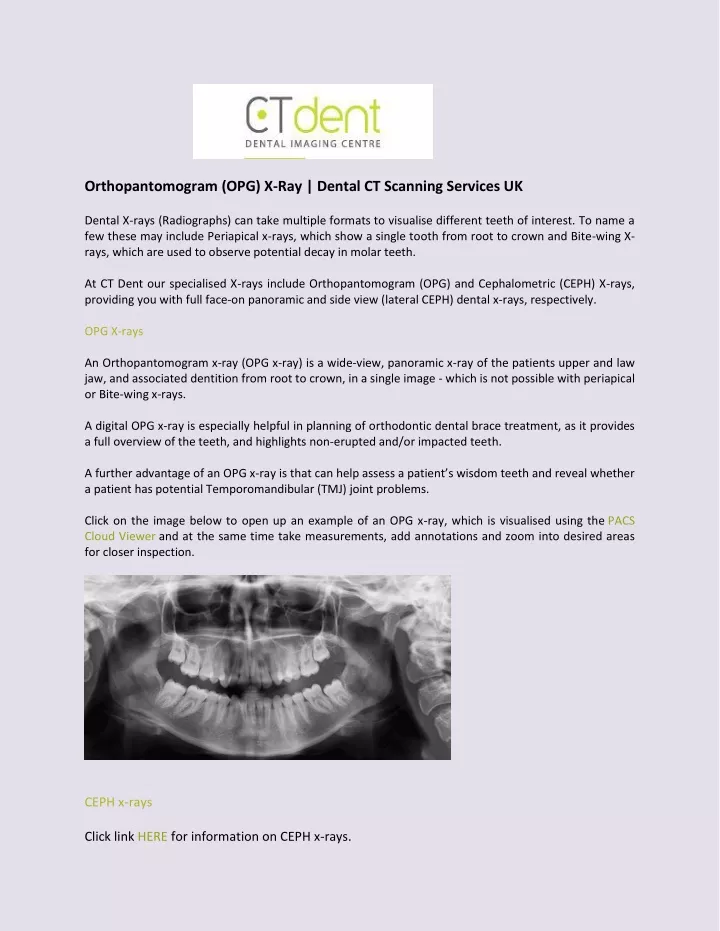 orthopantomogram opg x ray dental ct scanning