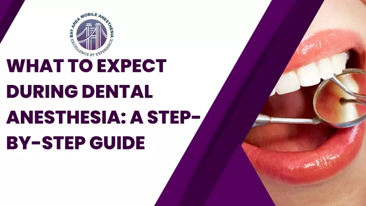 what to expect during dental anesthesia a step