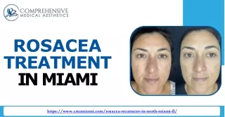Get Expert Rosacea Care in Miami with Comprehensive Medical Aesthetics