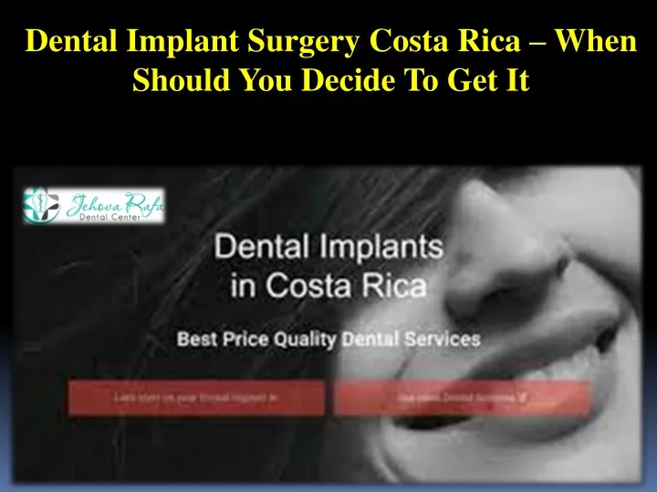 dental implant surgery costa rica when should