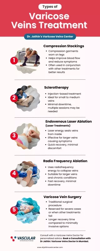 Types of Varicose Vein Treatment