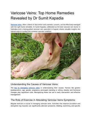 Varicose Veins- Top Home Remedies Revealed by Dr. Sumit Kapadia