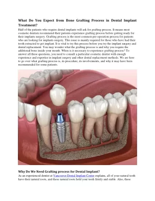 What Do You Expect from Bone Grafting Process in Dental Implant Treatment