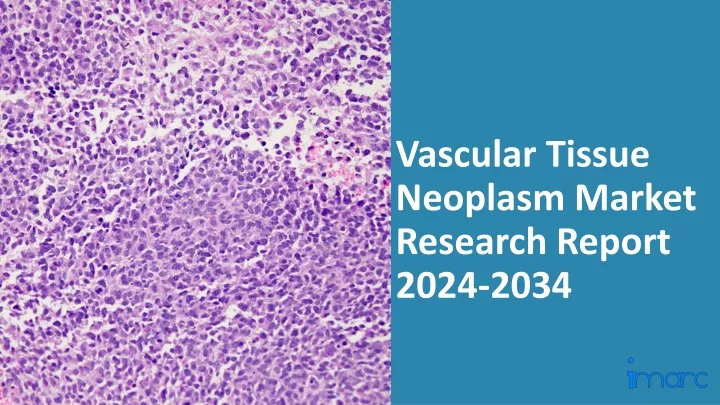 vascular tissue neoplasm market research report 2024 2034