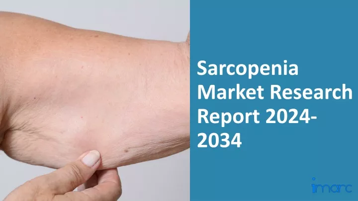 sarcopenia market research report 2024 2034