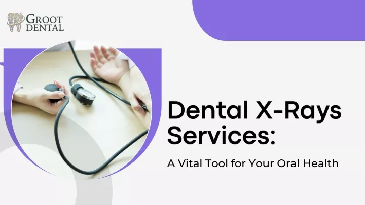 dental x rays services
