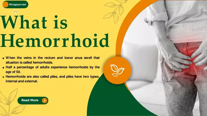 Ppt What Is Hemorrhoid Powerpoint Presentation Free Download Id12963962 3168