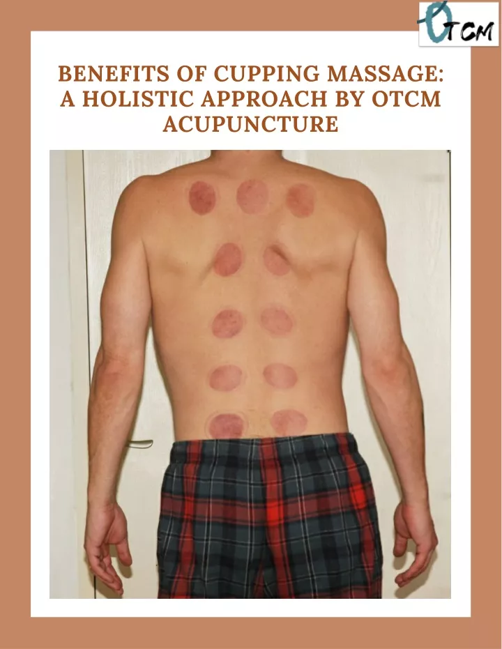 benefits of cupping massage a holistic approach