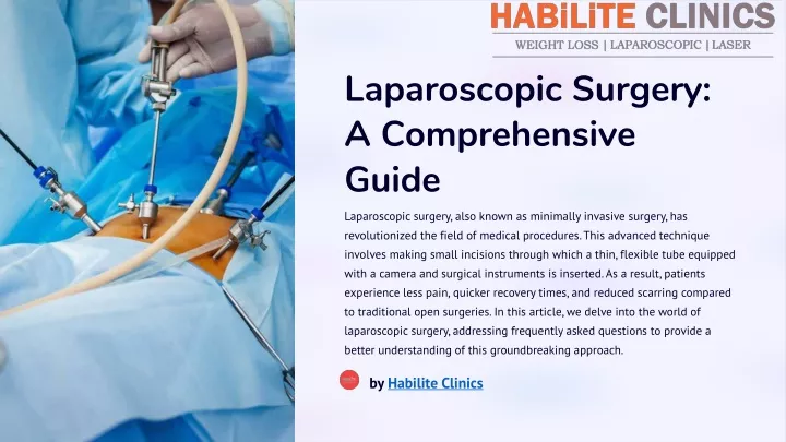 laparoscopic surgery a comprehensive guide