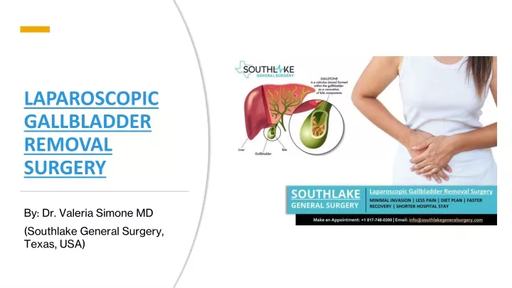 laparoscopic gallbladder removal surgery