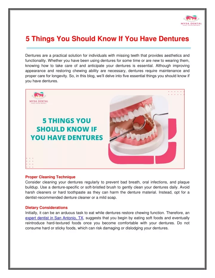 5 things you should know if you have dentures