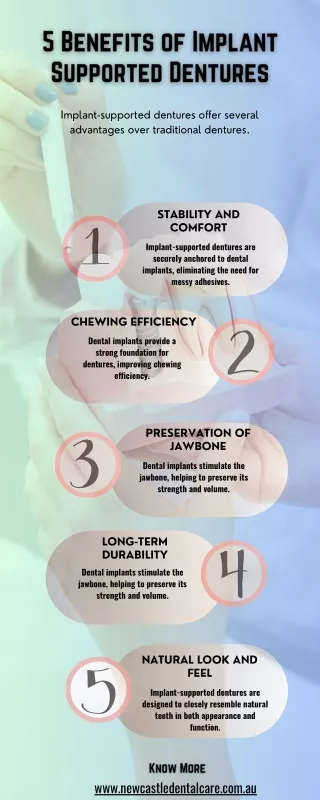 5 Benefits of Implant Supported Dentures