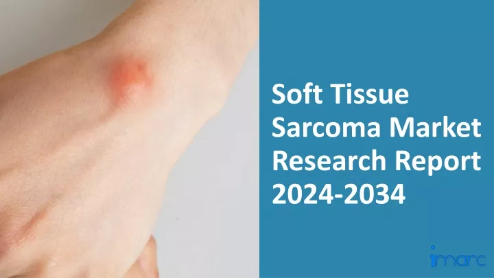 soft tissue sarcoma market research report 2024 2034