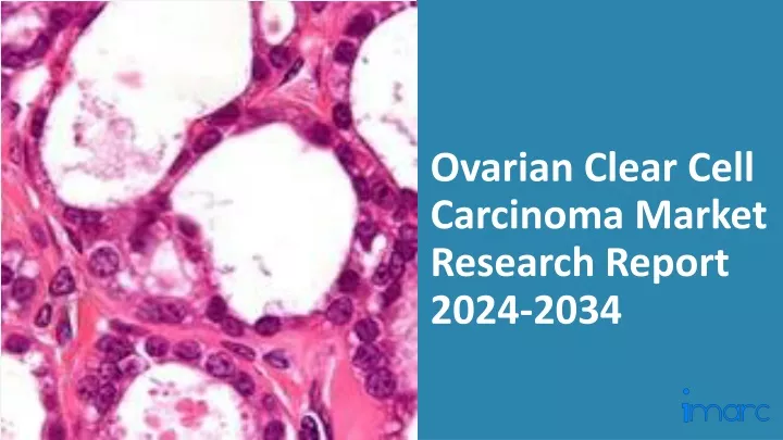 ovarian clear cell carcinoma market research report 2024 2034