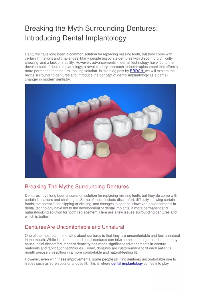 breaking the myth surrounding dentures