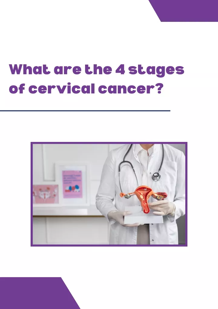 what are the 4 stages of cervical cancer