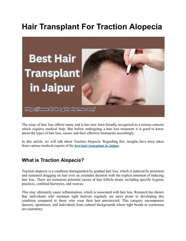 hair transplant for traction alopecia