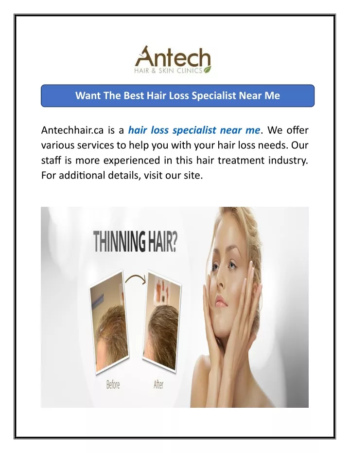 want the best hair loss specialist near me