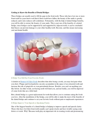 Getting to Know the Benefits of Dental Bridges