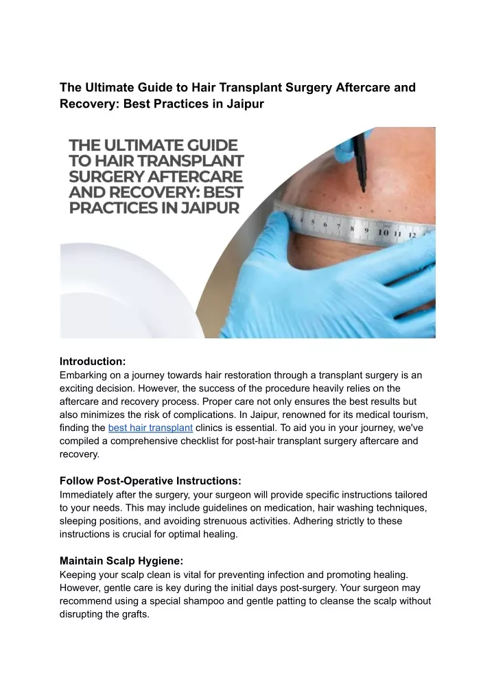 the ultimate guide to hair transplant surgery