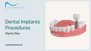 Dental Implants Procedures Summarized Step by Step