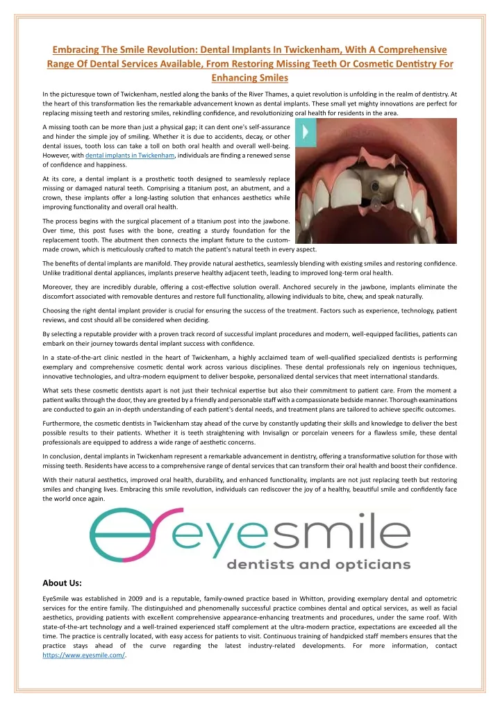 embracing the smile revolution dental implants