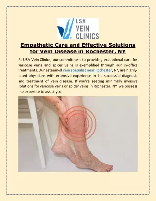 Empathetic Care and Effective Solutions for Vein Disease in Rochester, NY