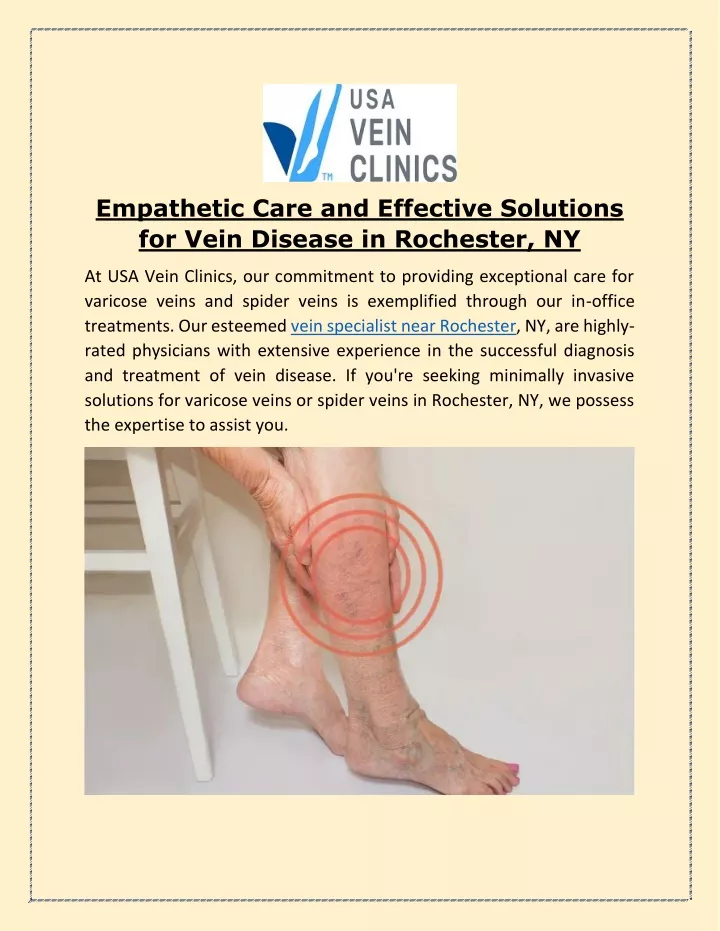 empathetic care and effective solutions for vein