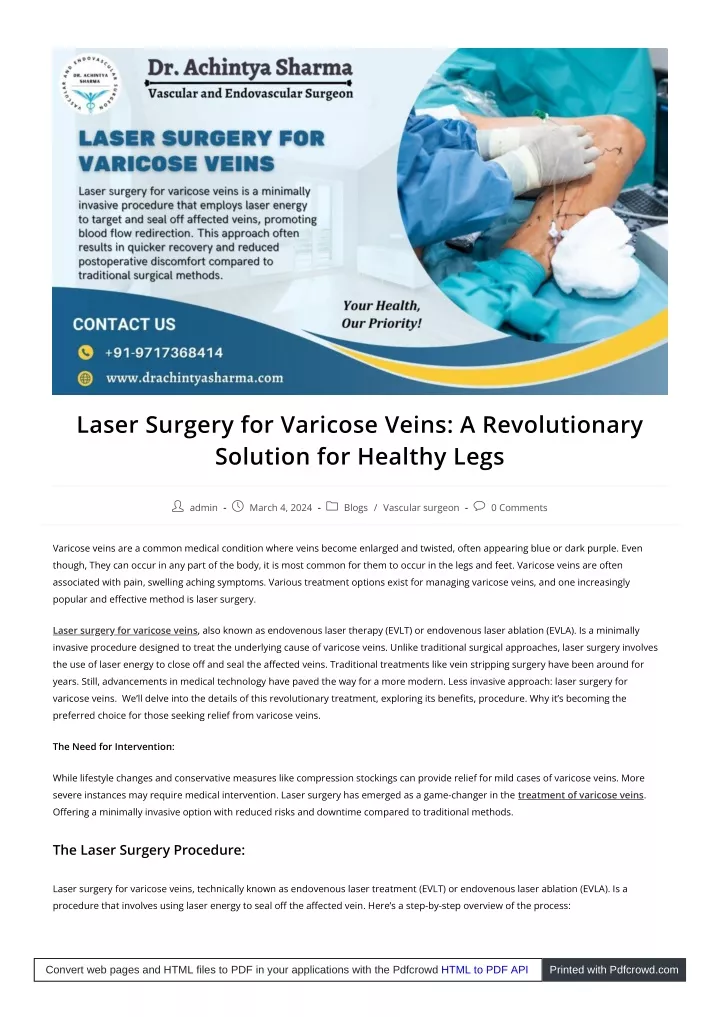 laser surgery for varicose veins a revolutionary