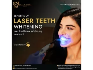 Benefits Of Laser Teeth Whitening at Lifecare Dental Clinic Chandigarh