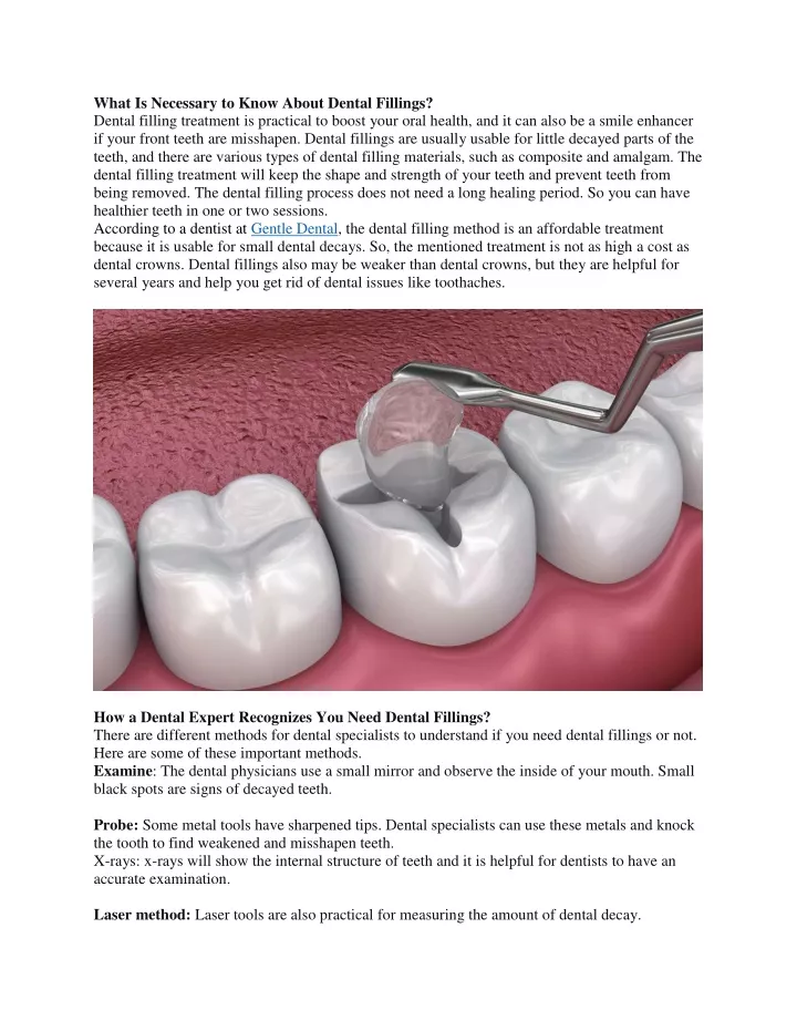 what is necessary to know about dental fillings