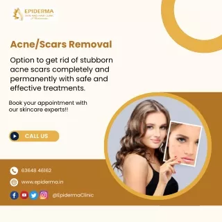 Acne or Scars Removal Treatment | Skin Clinic Jayanagar | Epiderma Clinic