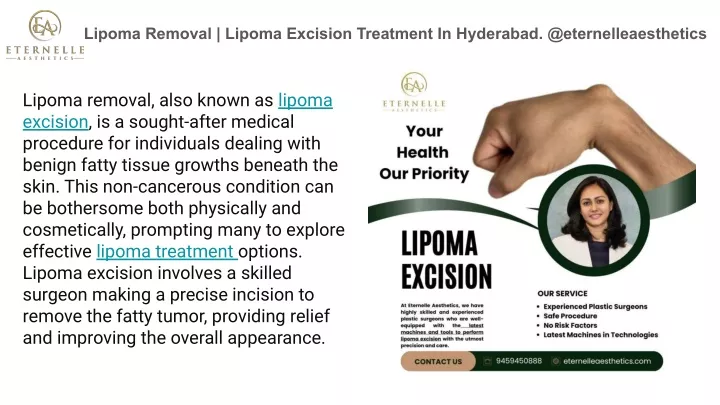 lipoma removal lipoma excision treatment