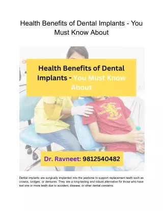 Health Benefits of Dental Implants - You Must Know About