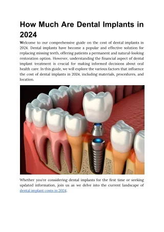How Much Are Dental Implants 2024
