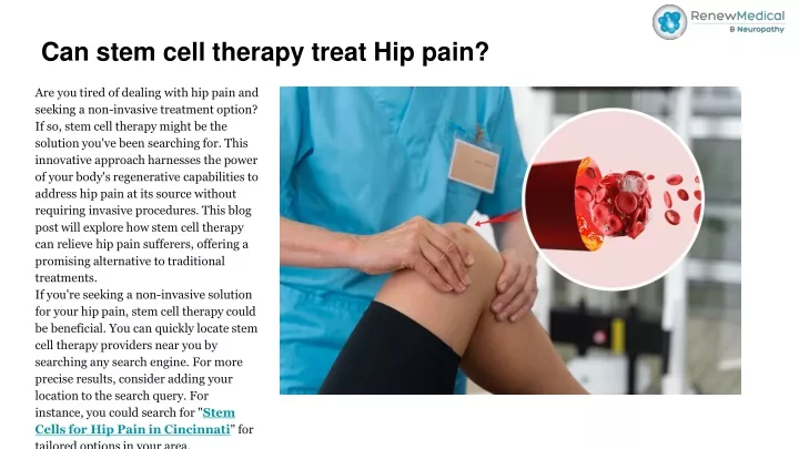 can stem cell therapy treat hip pain